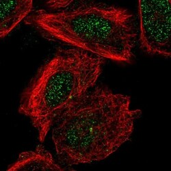 TMEM93 Antibody, Novus Biologicals 0.1mL; Unlabeled:Antibodies, Polyclonal